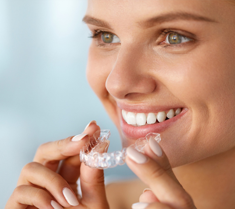 invisalign in burnaby