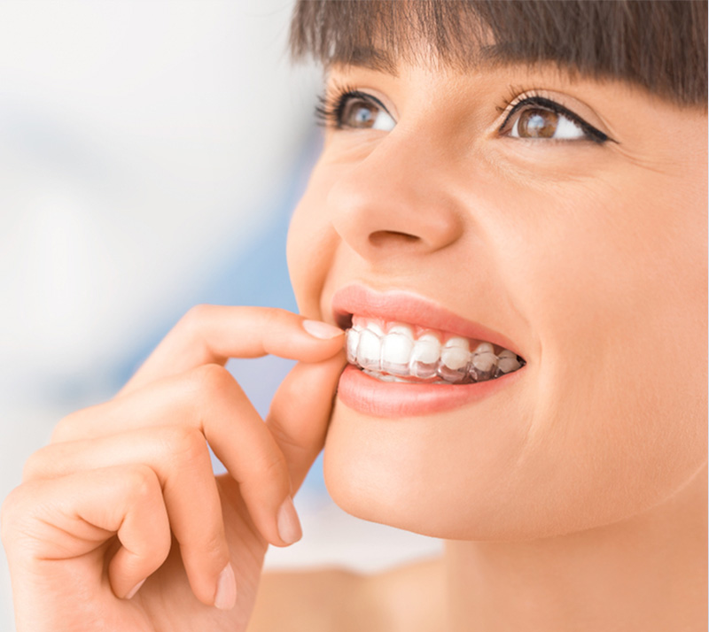 orthodontics in burnaby