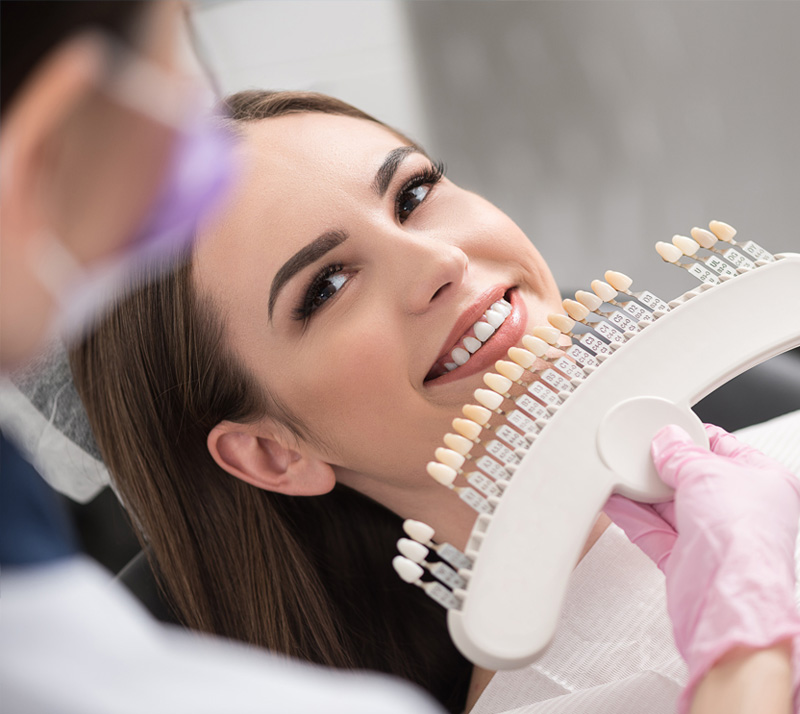 porcelain veneers in burnaby