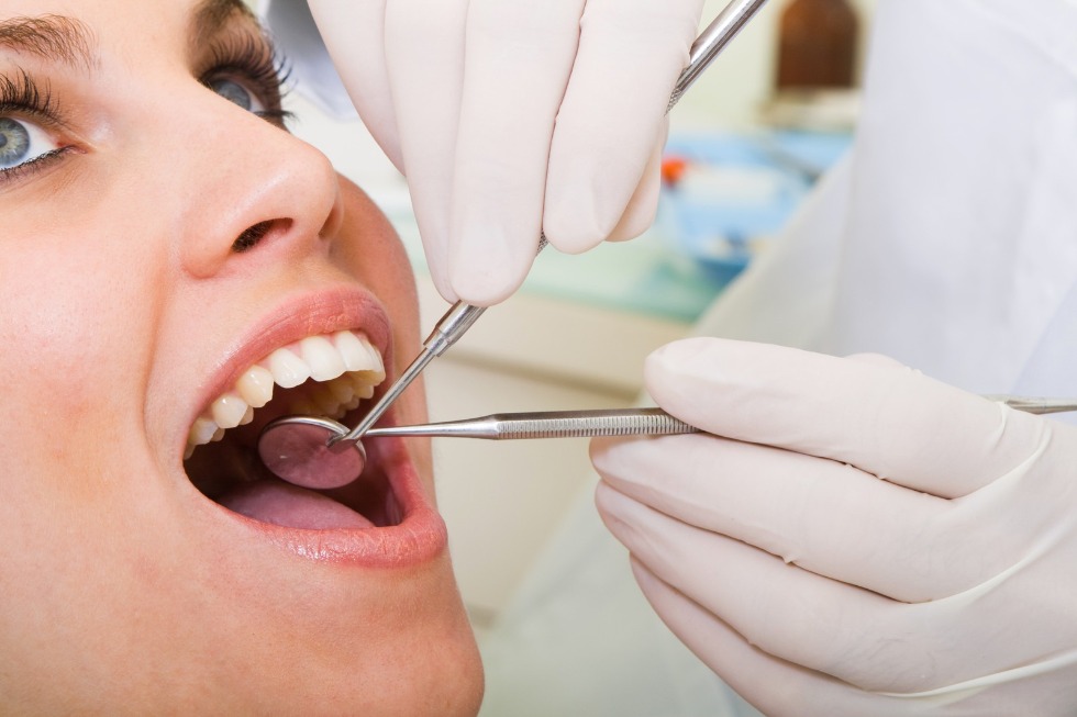 Why You Need to Replace Your Amalgam Fillings?