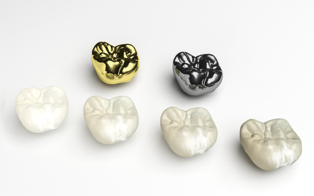 Dental Crown Treatment Guide – Eagle Creek Dental