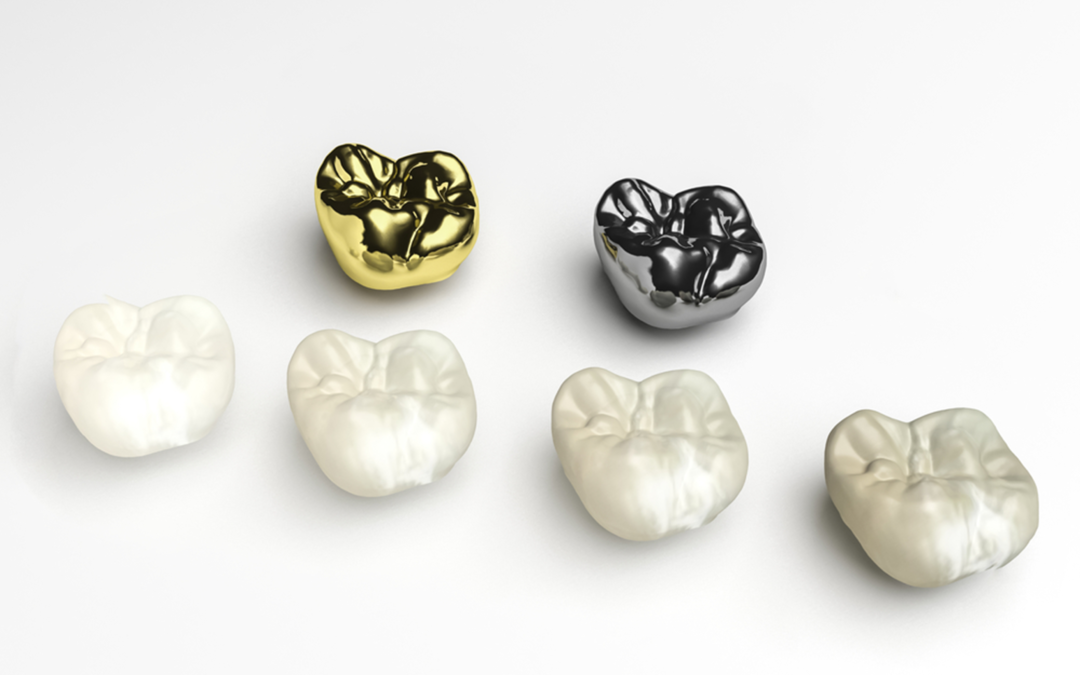 dental crowns in burnaby