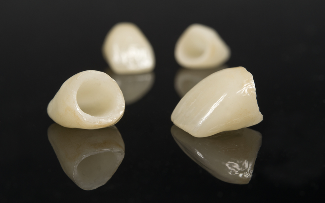 Find Your Perfect Crown – Eagle Creek Dental